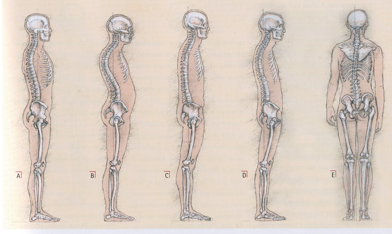 Exemplos de problemas posturais